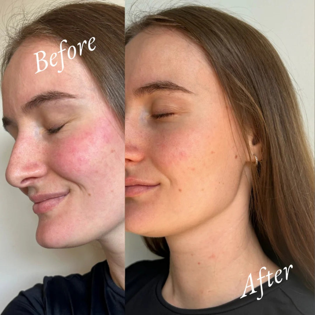 Her Serum Face~Body~Bump