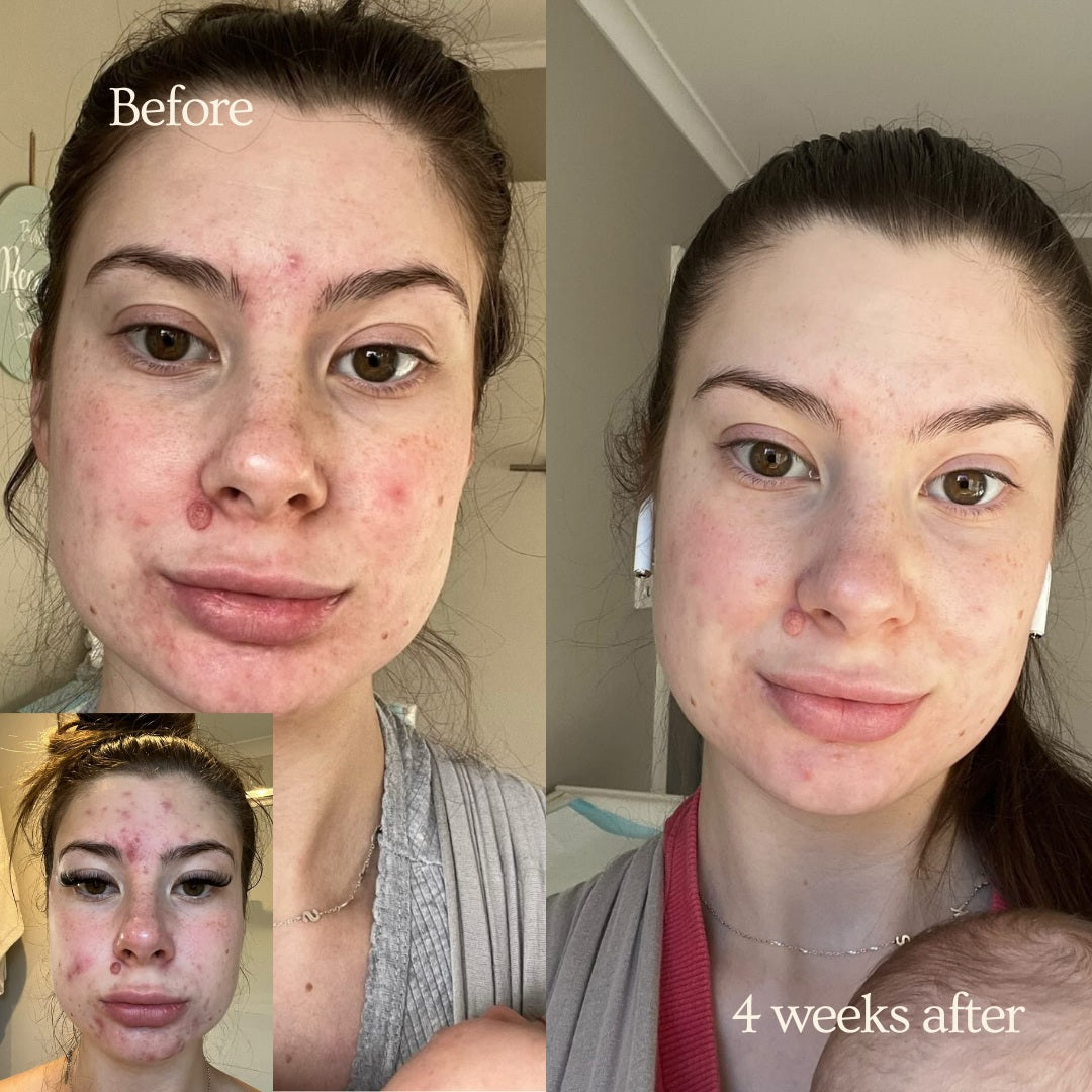 Her Serum Face~Body~Bump