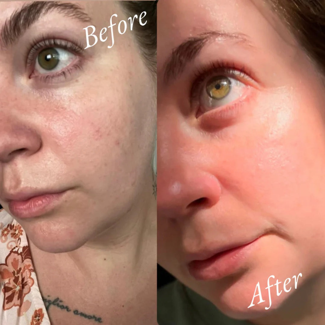 Her Serum Face~Body~Bump